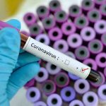 Coronavirus Testing Protocol to Go Hand in Hand with Our Healthcare Capacity: AIIMS’ Guleria