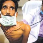 TB Case Detection in India Down By 75 Per Cent During Lockdown, Could Lead to Major Spike: WHO