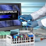 On World Hemophilia Day, Some of the Top Advances
