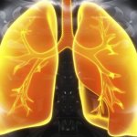 AI system beats radiologists at predicting lung cancer risk