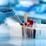 Global Cord Blood Corporation Announces Receipt of Preliminary Non-Binding Proposal to Acquire the Company