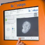 Ikonisys & Sheba Medical Center-ARC Partner to Detect & Target Cancer with Novel Technology