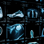 Nines Banks $16.5M for Tele-radiology, AI Imaging Triage Platform