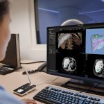 Philips Unveils Next-Gen Enterprise Imaging Solution to Embed Intelligence Across Patient Journey