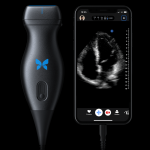 Butterfly IQ Expands Whole-Body Ultrasound System to Android Devices