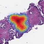 Paige Raises $45M to Expand AI-Native Digital Pathology Ecosystem to Accelerate Biomarker Discovery