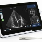 AI-Assisted Cardiac Ultrasound Guidance Software Receives De Novo Clearance