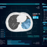 RADLogics Brings AI-Powered COVID-19 Apps for CT & X-rays to U.S. Market