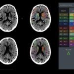 Rapidai Snags FDA Clearance for Neuroimaging Analysis Device