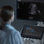 Intel, Samsung Collaborate on AI-Powered Fetal Ultrasound Smart Workflow