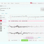 AI Leads Way to Less False Positives on Remote Cardiac Monitoring Devices, Improved Results