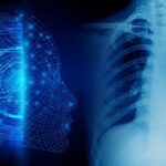 GE Healthcare Unveils First X-Ray AI Algorithm to Assess ETT Placement for COVID-19 Patients
