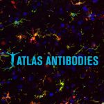 Atlas Antibodies Acquires Histocyte Laboratories, a Global Leader in Cell Line Controls for Histopathology