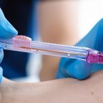 Holy Name to Offer Needle-Free Blood Draws for Inpatients, First Hospital in NJ