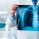 VUNO Publishes Study of Its AI-powered Solution Improving Chest X-Ray Reading Accuracy