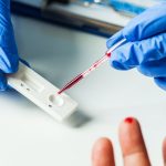 Vatic Antigen Test Achieves CE Mark Status