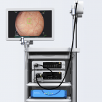 FDA Greenlights Medtronic’s AI Tool That Finds Polyps During Colonoscopies
