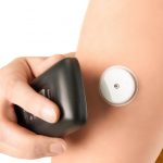 Metronom Health, Dinova Medtech Looking to Launch Continuous Glucose Monitoring Device in China