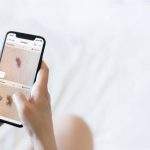 Skin Checking App Miiskin Launches Mole Sizing Feature