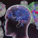 Omniscient Neurotechnology Gets US FDA Clearance for Brain Mapping Software