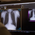 Australian Radiology Centre Sonic Imaging to Implement Annalise.ai’s Chest X-Ray Platform
