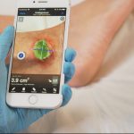 Swift Medical’s New Imaging Platform Expands the Digital Wound Care Company Into Decentralized Trials