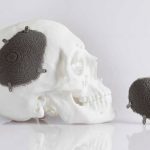 Analysis of Regional Opportunities Awaiting for Manufacturers in 3D Printed Medical Implants Market