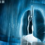 Andhra Medical College Tries Out AI Platform for Lung Health Assessment