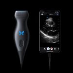 Gates Foundation Donates $5M for 1,000 Butterfly Ultrasounds to Sub-Saharan Africa