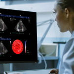 DiA Imaging Analysis Partners with Intel to Improve Ultrasound Analysis By 40%