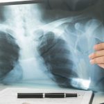 Lunit Integrates AI Chest X-Ray Solution Into Cathay Life Insurance’s Underwriting Process