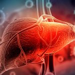 GENFIT Drops up to $105M for Versantis to up Liver Game