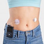 Medtronic Launches World’s First and Only Infusion Set for Insulin Pumps