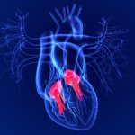 Robotics + Heart Valve Startup, Capstan Medical Raises $31.4M