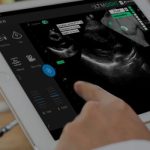 Elucid Raises $80M to Drive Commercialization of AI-powered Cardiovascular Diagnostic Tools