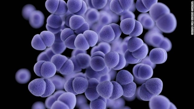 130916171028-methicillin-resistant-staphylococcus-aureus-mrsa-story-top