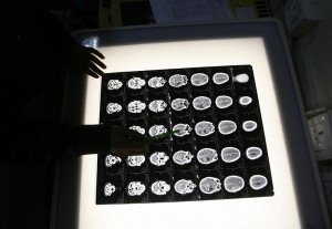 brain-x-ray